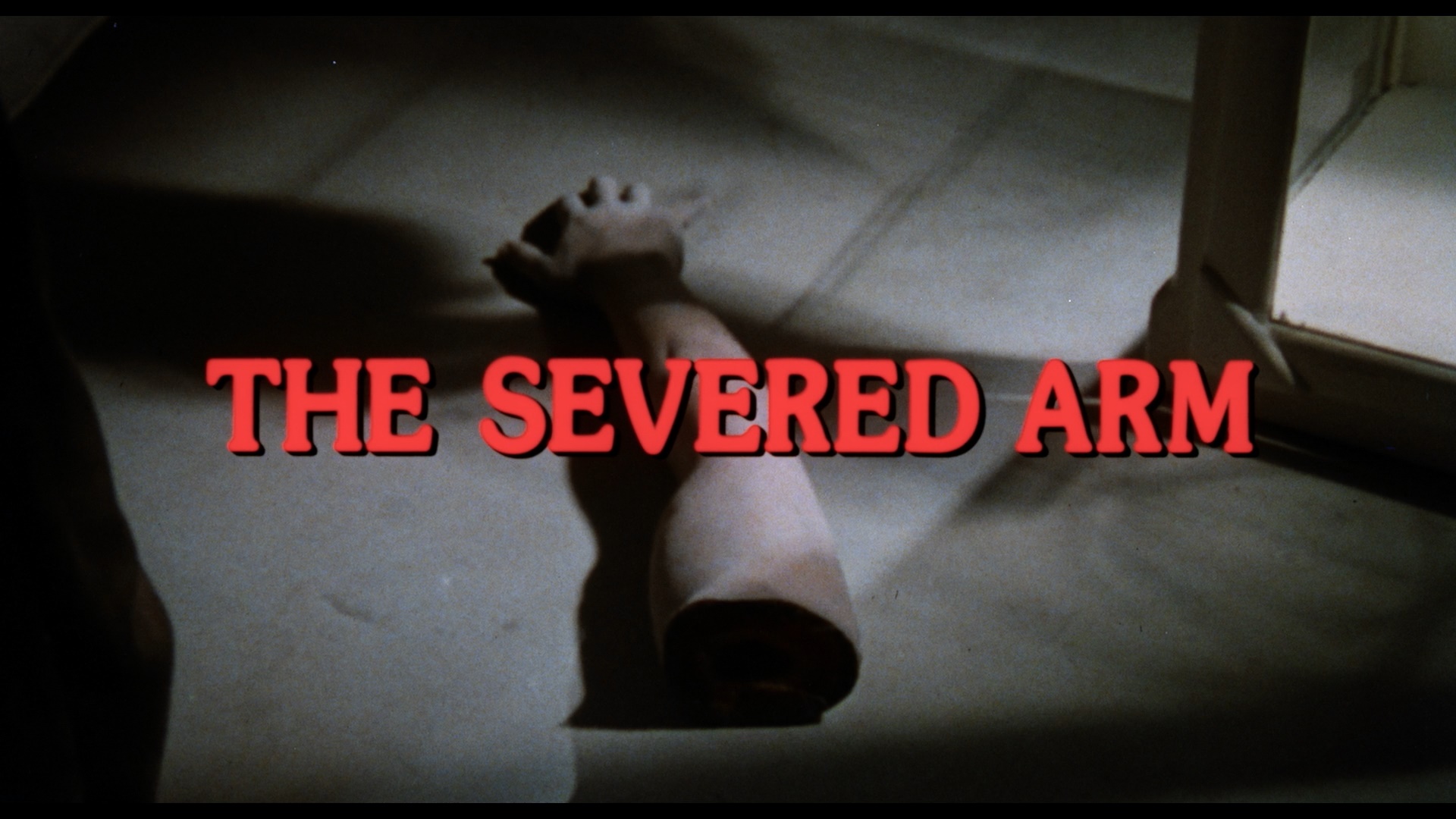 The Severed Arm