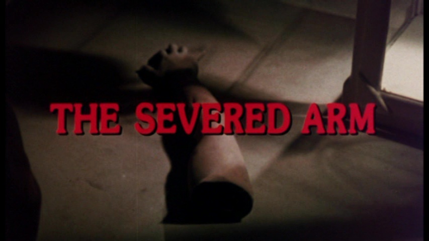 The Severed Arm